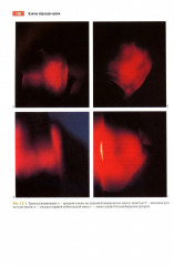 Атлас манипуляций в неонатологии - Фото 5