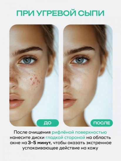 Пилинг-пэды для лица с гликолевой кислотой