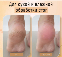 Тёрка педикюрная из нано-стекла - Фото 6