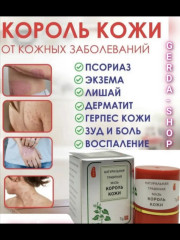 Натуральная травяная мазь «Король Кожи» - Фото 1