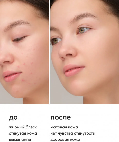 Очищающий гель для умывания с АНА-кислотами