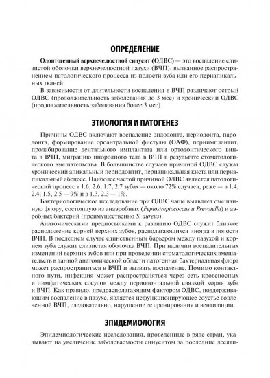 Одонтогенный верхнечелюстной синусит