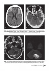 Лучевая диагностика при заболеваниях системы крови - Фото 10