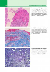 Патологическая анатомия. Атлас. Том 2. Частная патологическая анатомия - Фото 9