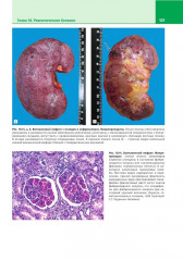 Патологическая анатомия. Атлас. Том 2. Частная патологическая анатомия - Фото 10