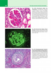 Патологическая анатомия. Атлас. Том 2. Частная патологическая анатомия - Фото 11