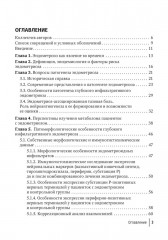 Глубокий инфильтративный эндометриоз. От патогенеза к лечению - Фото 1