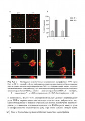 Глубокий инфильтративный эндометриоз. От патогенеза к лечению - Фото 8