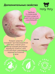 Пенка для проблемной кожи лица против акне «Bye Bye Acne!» - Фото 2