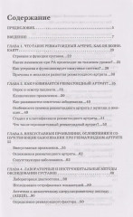 Ревматоидный артрит. Часть первая - Фото 2