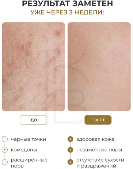 Очищающее масло для лица «Ginseng Cleansing Oil»