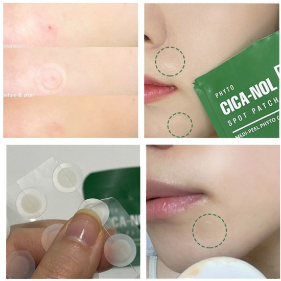 Точечные патчи от прыщей с центеллой «Phyto Cica-Nol B5 Spot Patch»