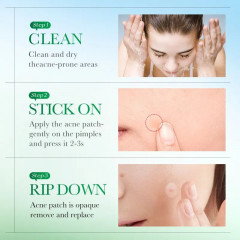 Патчи для лица против воспалений «Acne Patch» - Фото 3