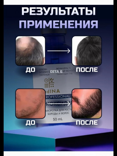 Средство от облысения «Trioxidil»