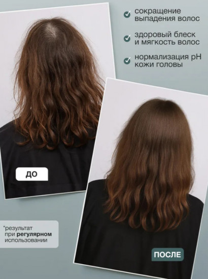 Сыворотка спрей для роста волос с розмарином