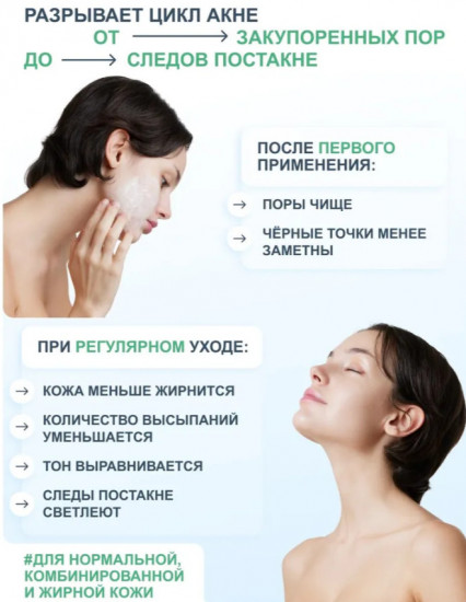 Энзимный гель для умывания лица с AHA + BHA кислотами и зелёным чаем