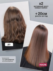 Набор для роста волос «Шампунь и кондиционер» - Фото 2