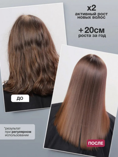 Набор для роста волос «Шампунь и кондиционер»