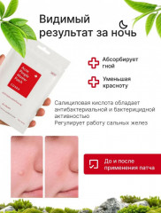 Патчи от акне противовоспалительные «Acne Pimple Master Patch» - Фото 3