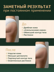 Щетка антицеллюлитная для сухого массажа - Фото 1