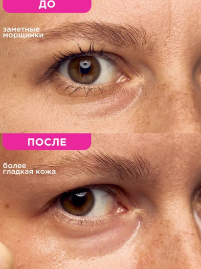 Патчи гидрогелевые для глаз от отеков и темных кругов с частичками золота