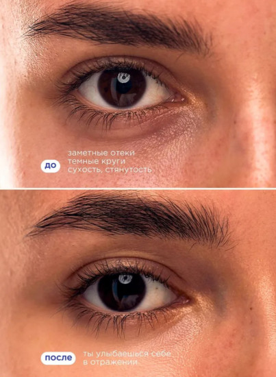 Патчи гидрогелевые для глаз от отеков и темных кругов с экстрактом бурых водорослей и экстрактом зелёного чая