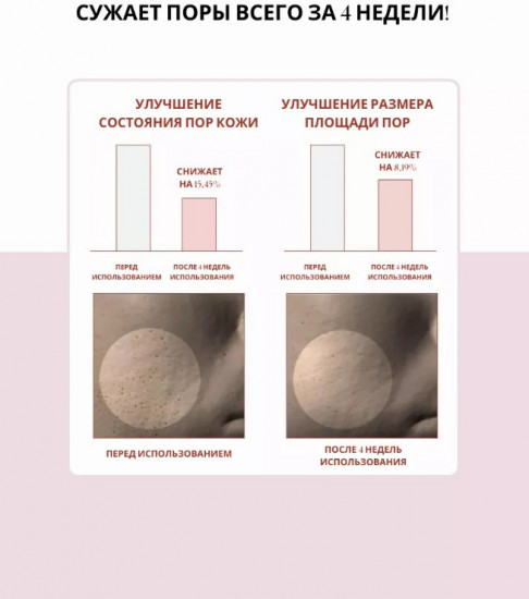 Тонер для сужения пор с центеллой «Poremizing Clear Toner»