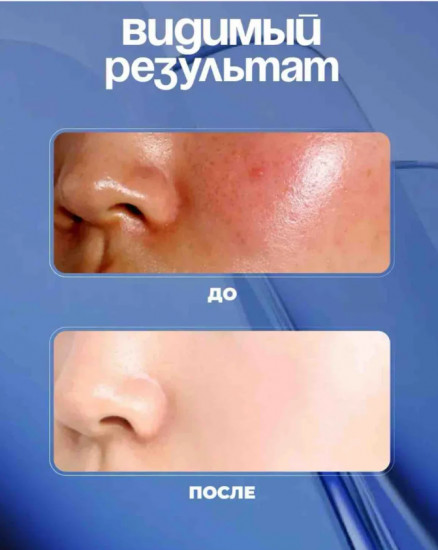 Сыворотка для лица осветляющая с закваской из риса и ниацинамидом