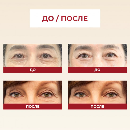 Крем для век с ретиналем «Eye Cream: Retinal Liposome 4% + Fermented Bean»