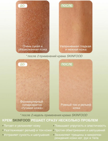 Крем для рук, тела, ног для сухой и очень сухой кожи «Skin Food»