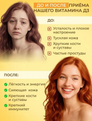 Витамин Д3 в капсулах - Фото 10