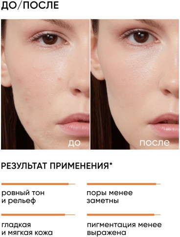 Миндальный смарт-пилинг система «Mandelic Smart Peel System 12%»