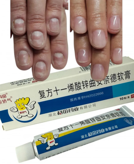 Крем от грибков на ногах и ногтях «Фуфанши»