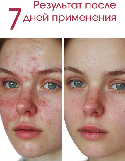 Тонер успокаивающий для лица «77% toner»