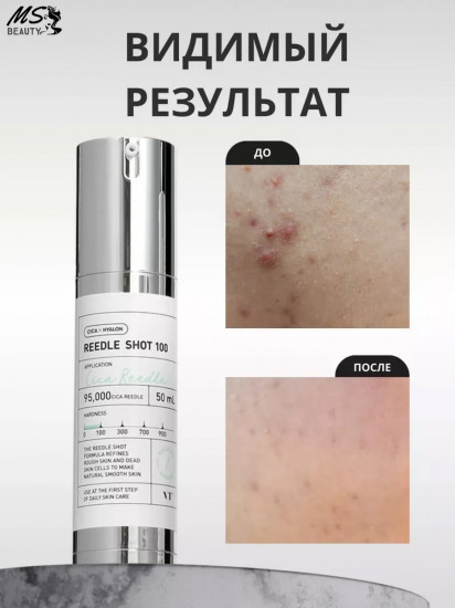 Сыворотка с микроиглами «Reedle Shot 100»