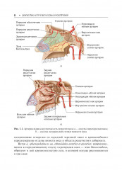 Диагностика и лечение носовых кровотечений - Фото 5