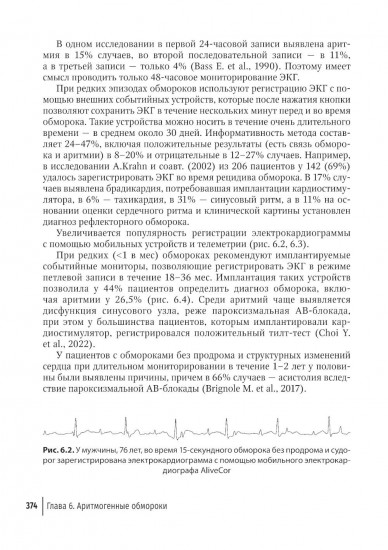 Аритмии сердца. Руководство для врачей