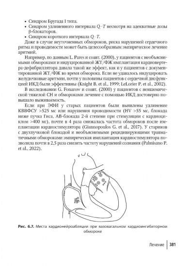 Аритмии сердца. Руководство для врачей