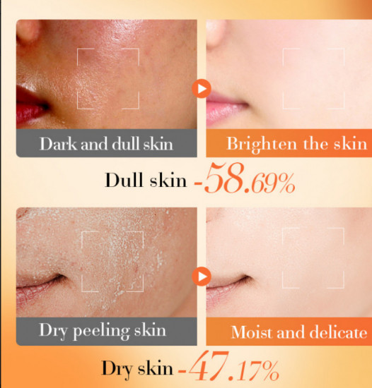 Крем для лица и зоны декольте «VE+B5 Moisturizing Cream»