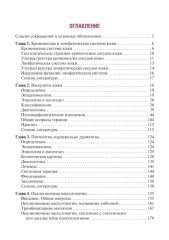 Сосудистые болезни кожи - Фото 1