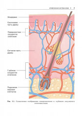 Сосудистые болезни кожи - Фото 4