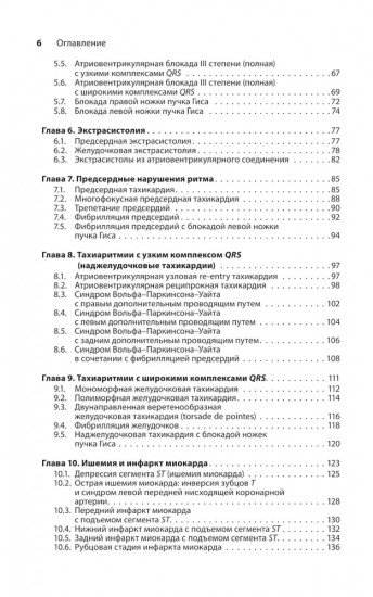 Карманный справочник по ЭКГ
