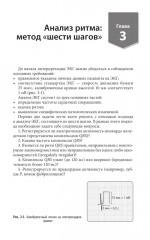 Карманный справочник по ЭКГ - Фото 4