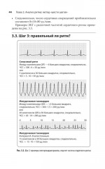 Карманный справочник по ЭКГ - Фото 7