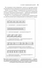 Карманный справочник по ЭКГ - Фото 8