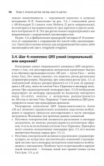 Карманный справочник по ЭКГ - Фото 9