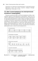 Карманный справочник по ЭКГ - Фото 10