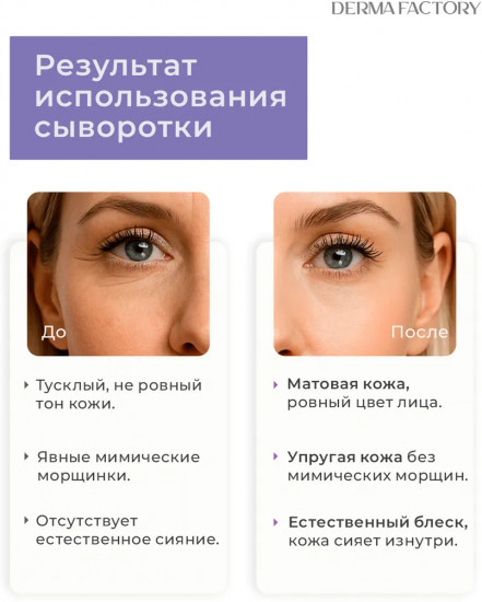 Сыворотка для упругости кожи вокруг глаз Volufiline