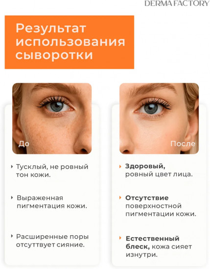 Сыворотка против пигментации «Niacin Tranexamic 13% Serum»