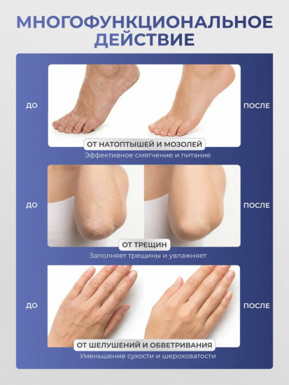 Крем-воск для сухой кожи «Кератозол»